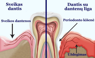 Periodonto ligos